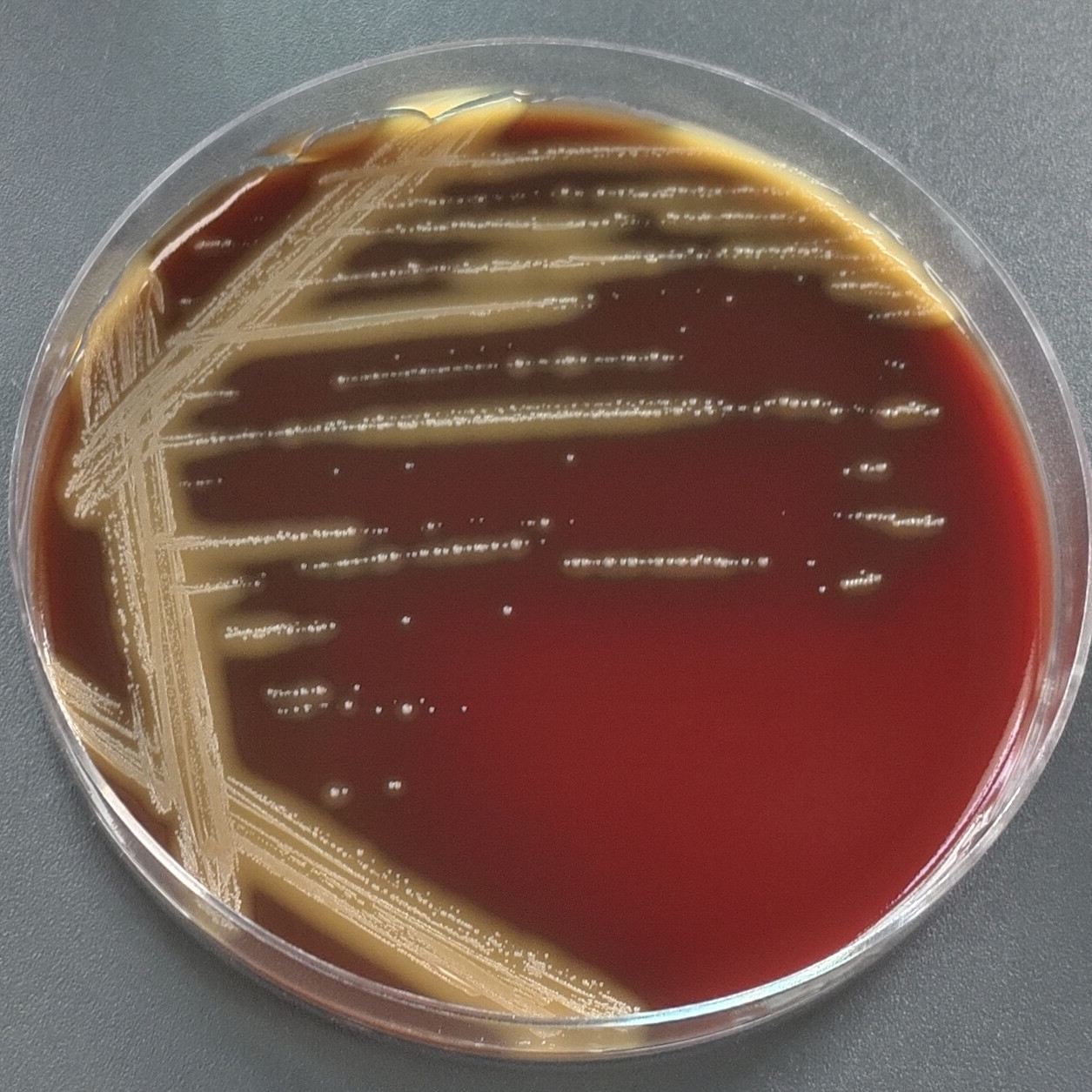 Avian Enterococcus-BNCC