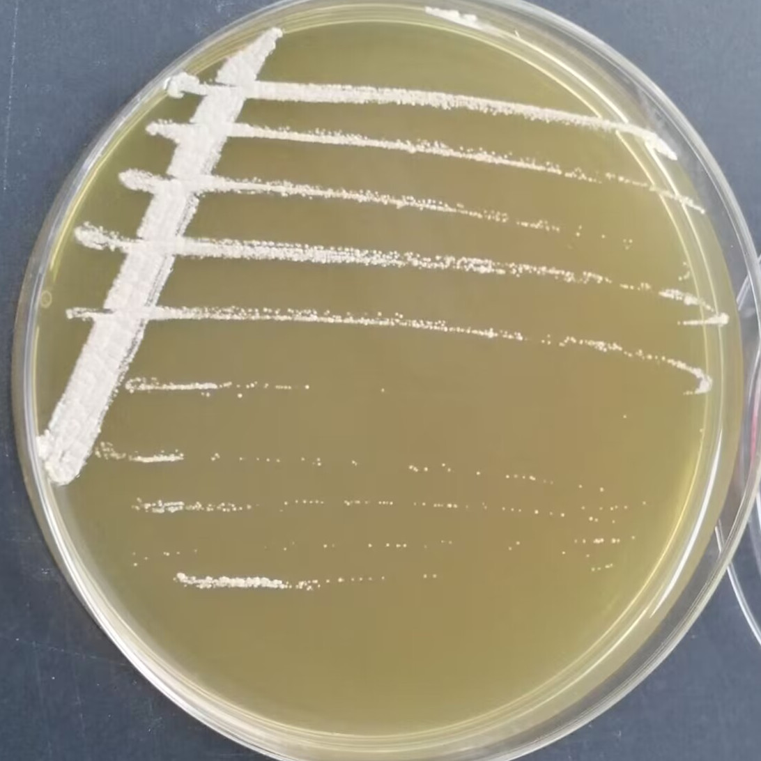 Nocardia in guinea pig ear inflammation-BNCC