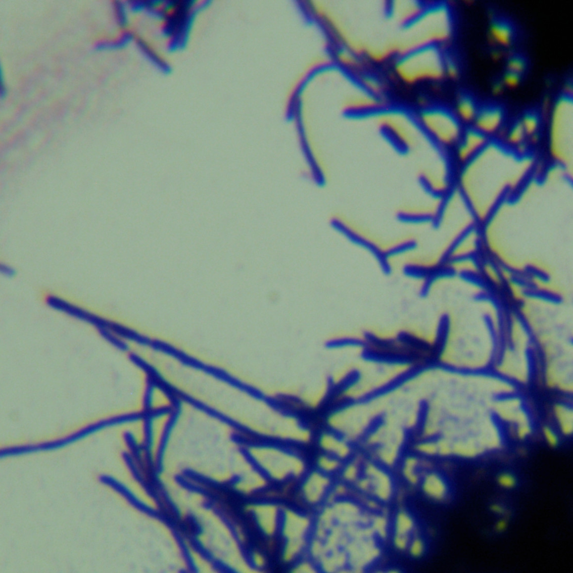 Nocardia in guinea pig ear inflammation-BNCC