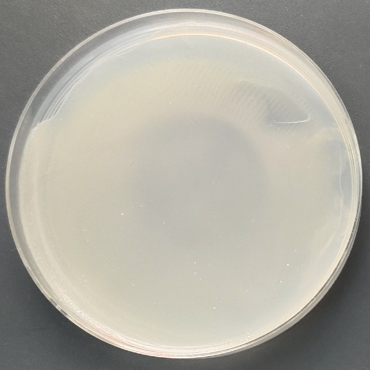 Gastric mycobacteria-BNCC