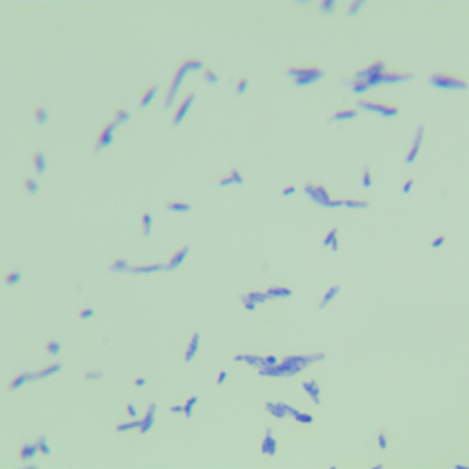 Gastric mycobacteria-BNCC