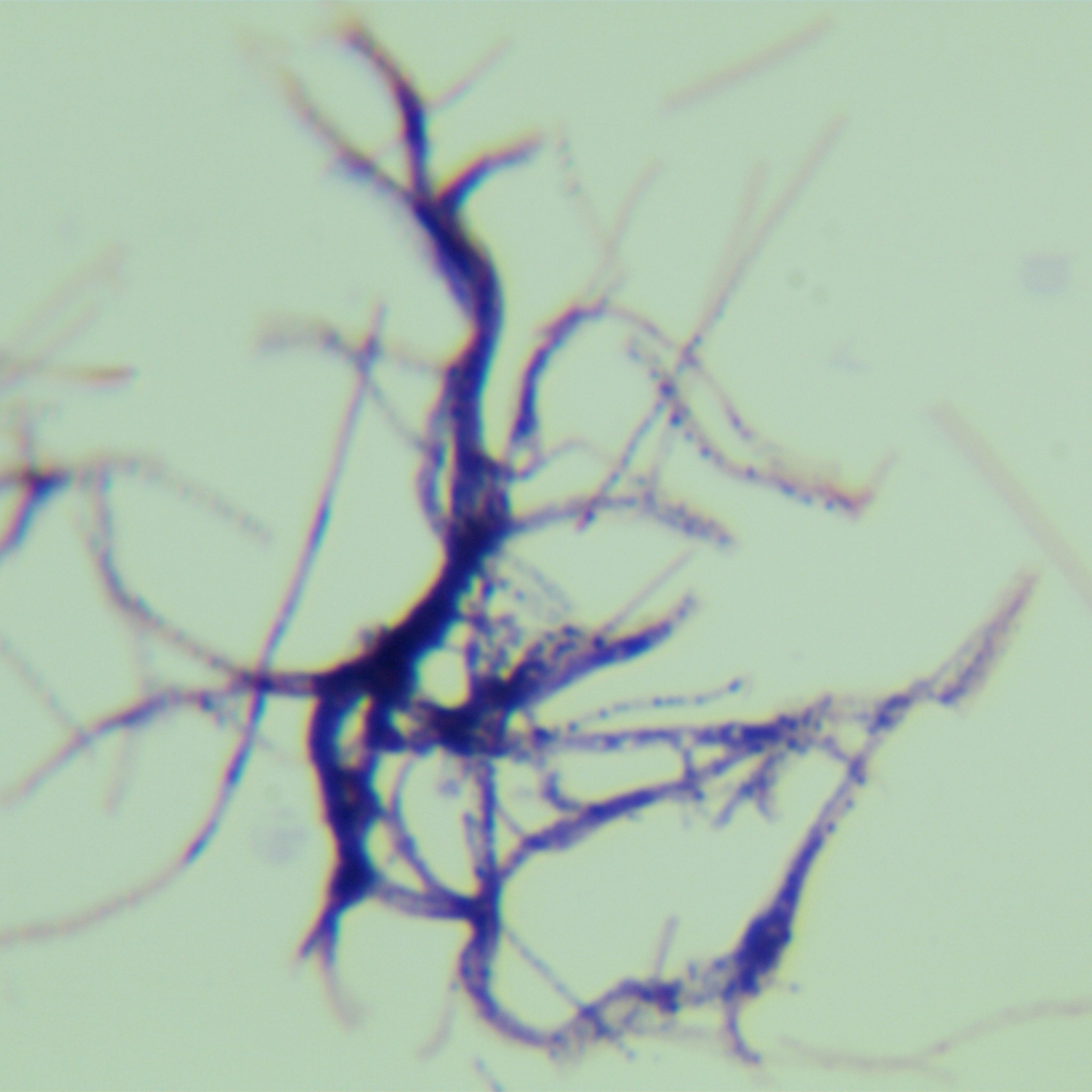 Streptomyces coelicolor-BNCC