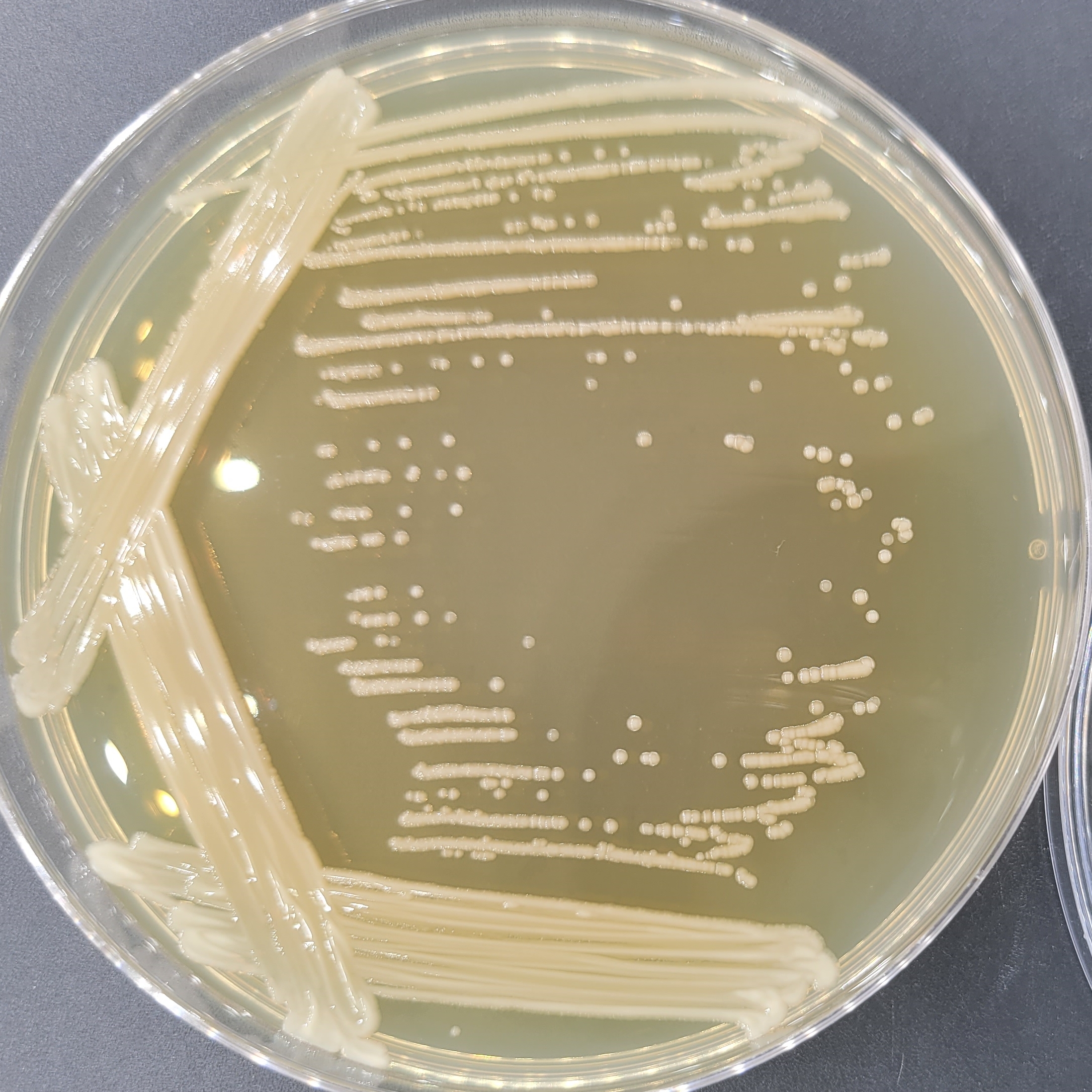 Acinetobacter hinginsii-BNCC