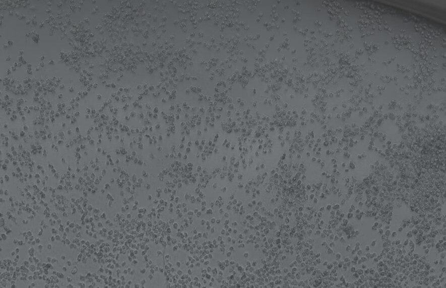 Human rhinovirus 16-BNCC