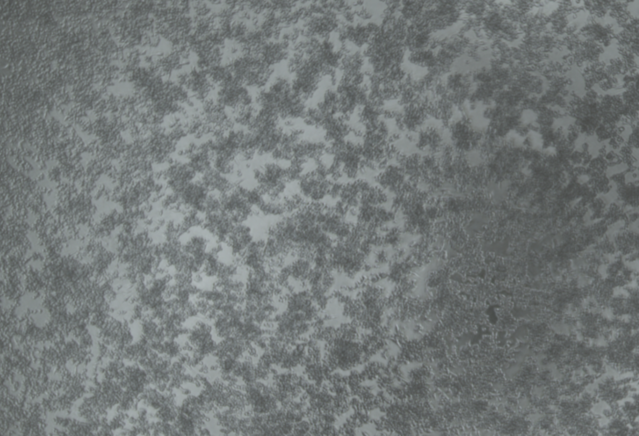 Human rhinovirus 1B-BNCC
