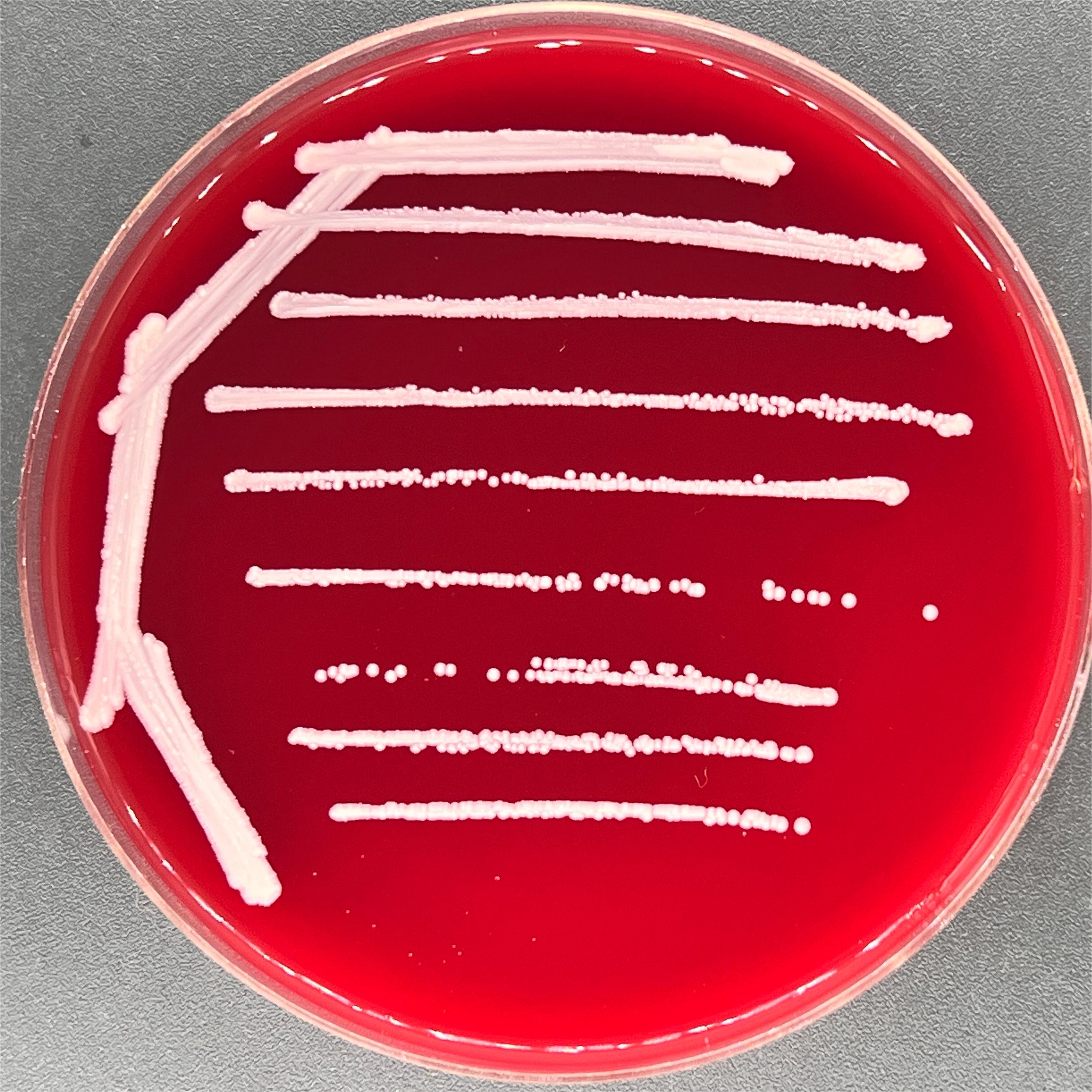 Fake Corynebacterium diphtheriae-BNCC