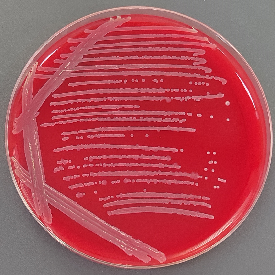 Bacillus subtilis-BNCC