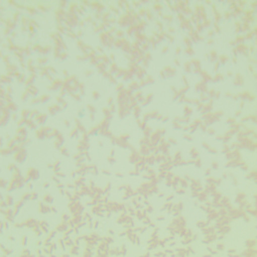 Shortwave Pseudomonas aeruginosa-BNCC