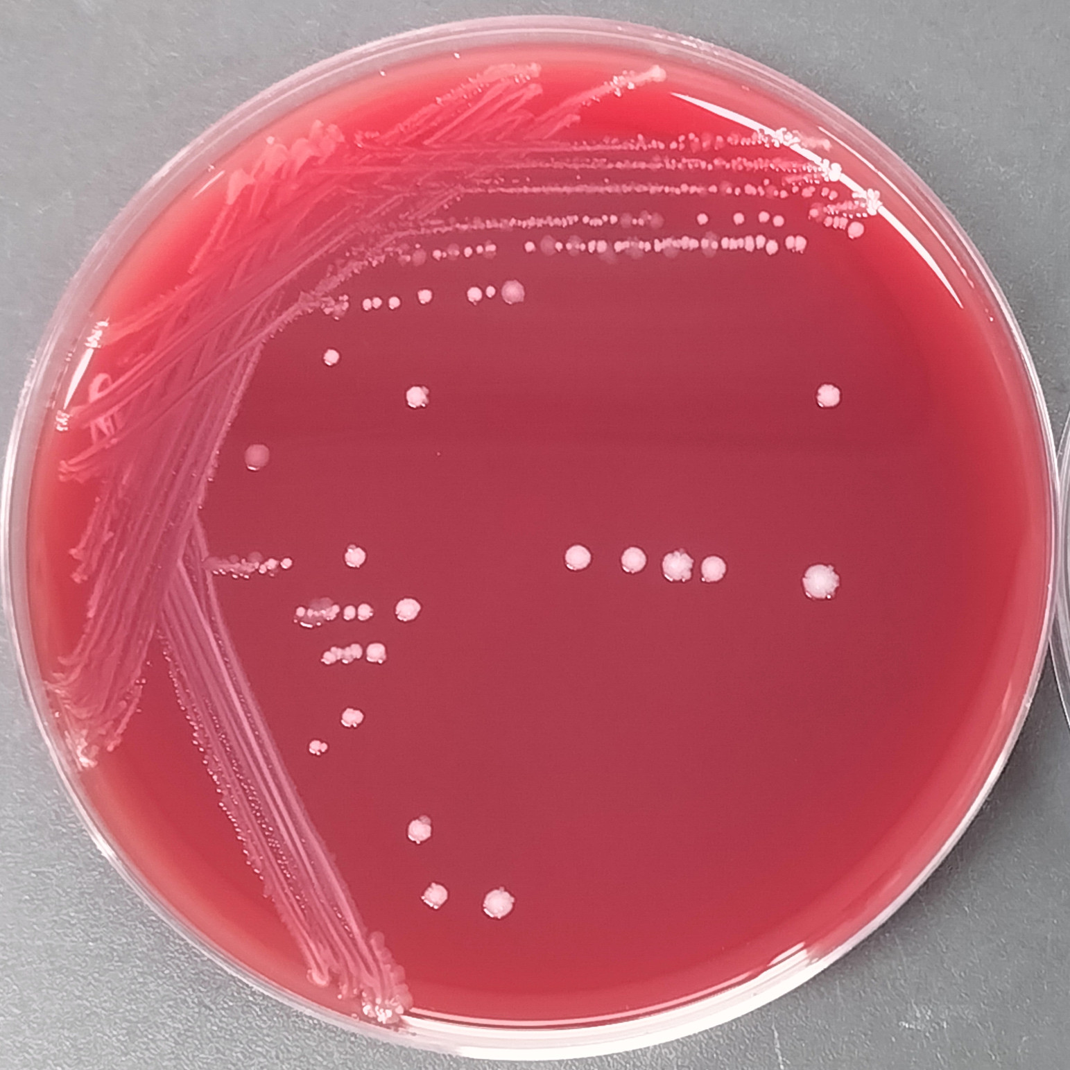 Fusarium oxysporum-BNCC