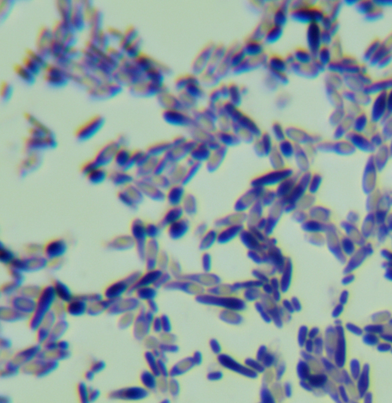 Fusarium oxysporum-BNCC