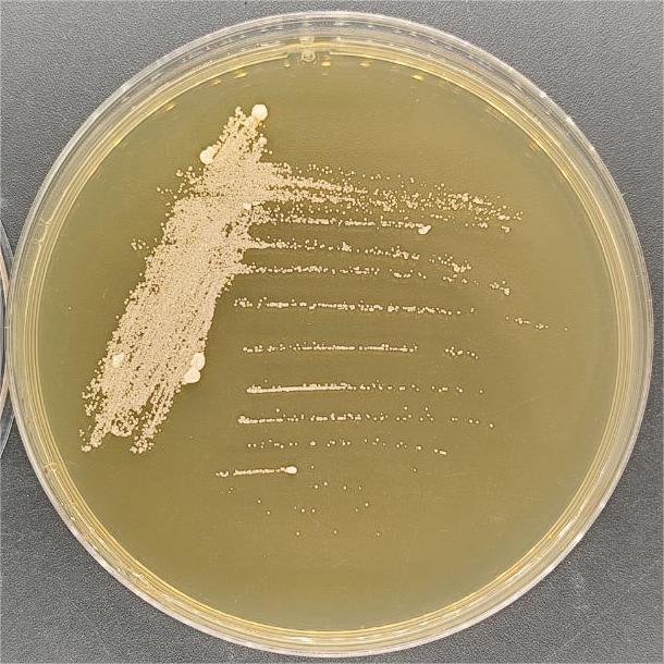 White Streptomyces subsp. albus-BNCC