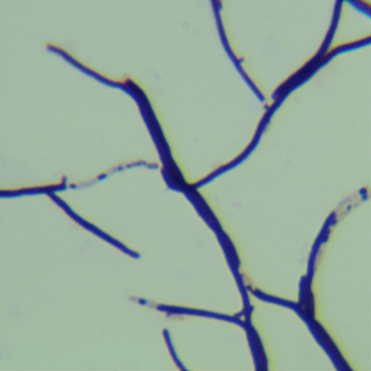 White Streptomyces subsp. albus-BNCC