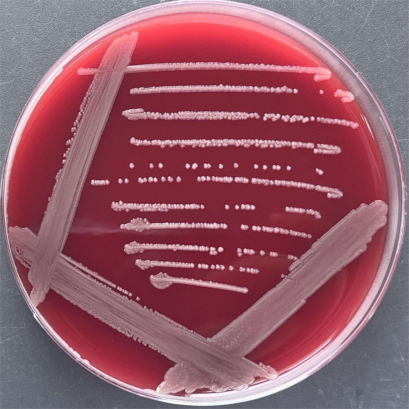 Urethral oligobacteria-BNCC