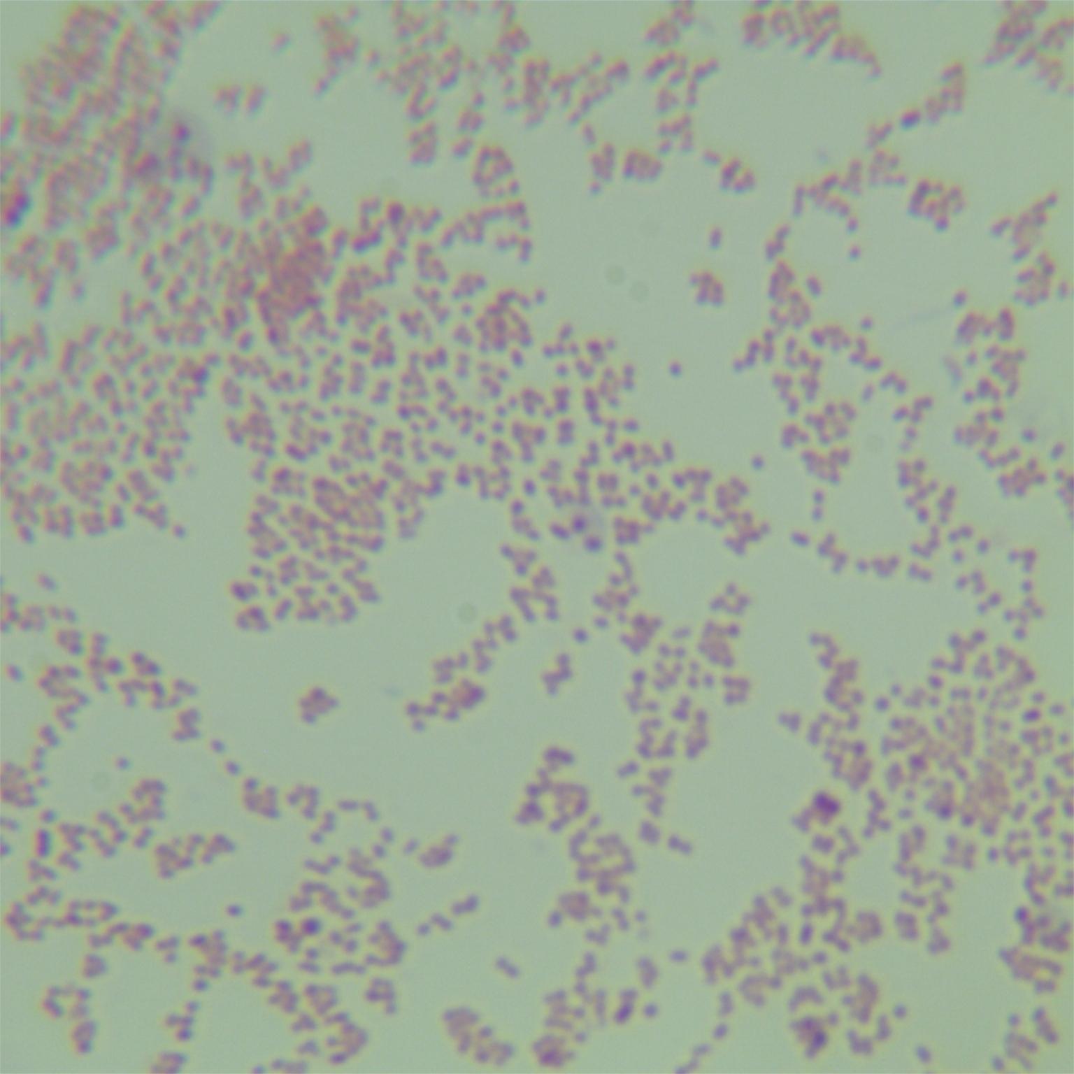 Urethral oligobacteria-BNCC