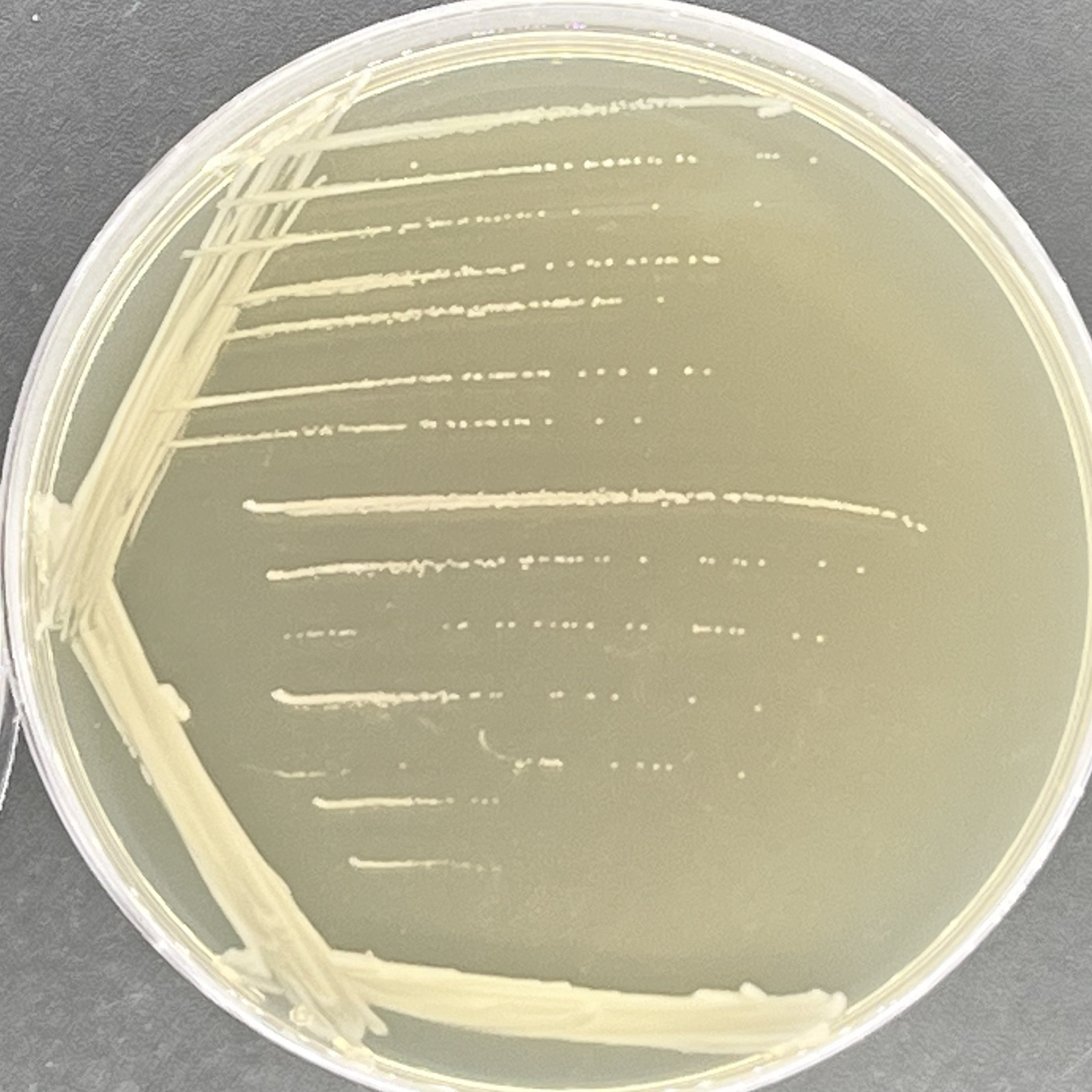 Phlegm Pandora bacteria-BNCC