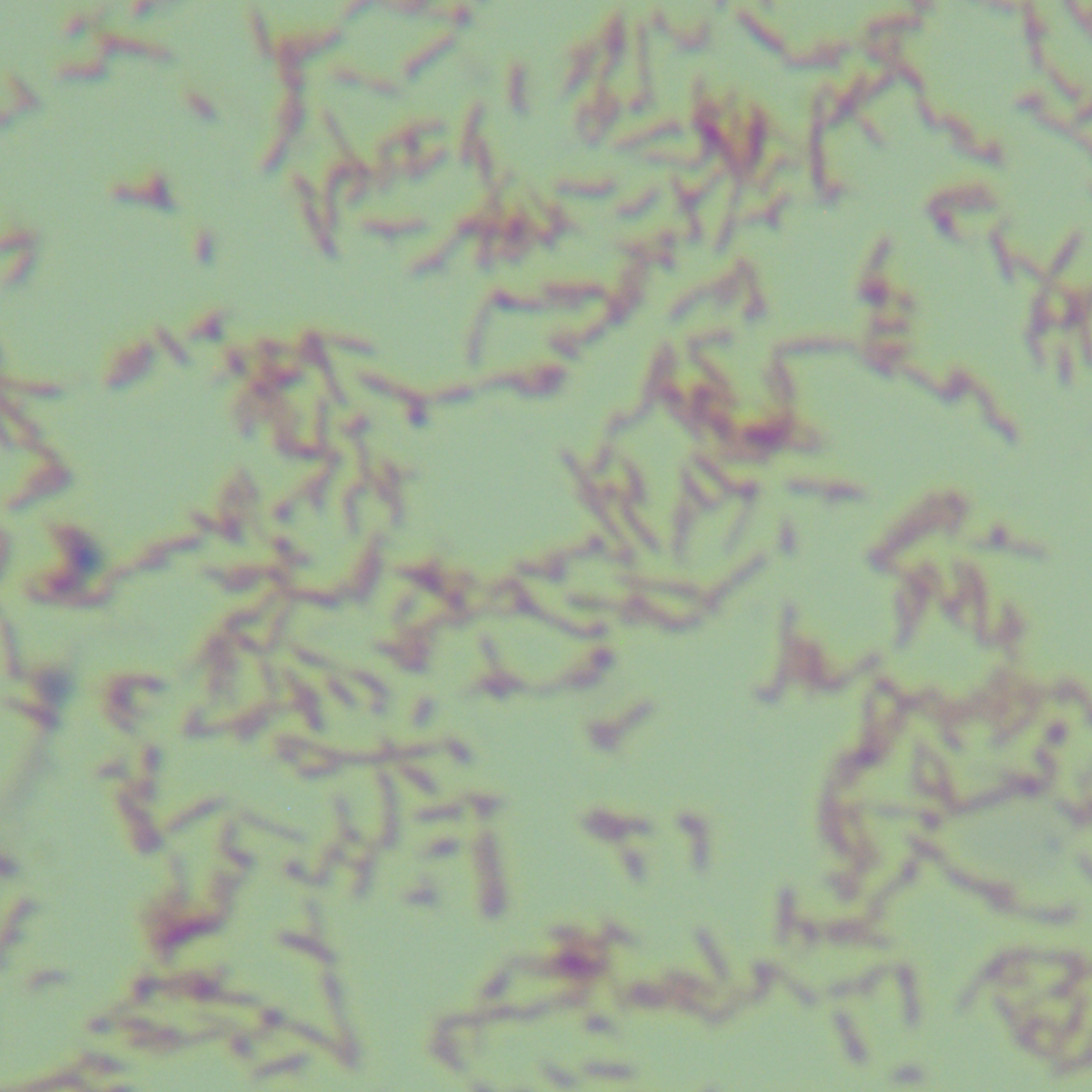 Phlegm Pandora bacteria-BNCC