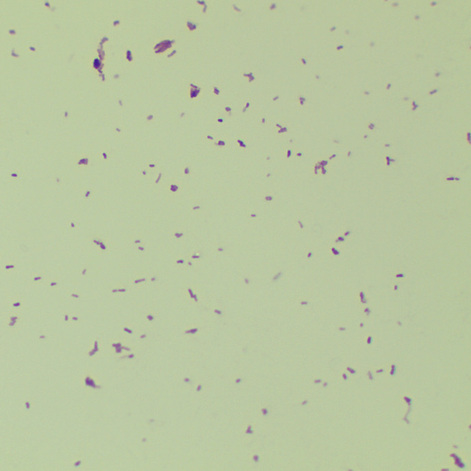Slow yellow mycobacteria-BNCC