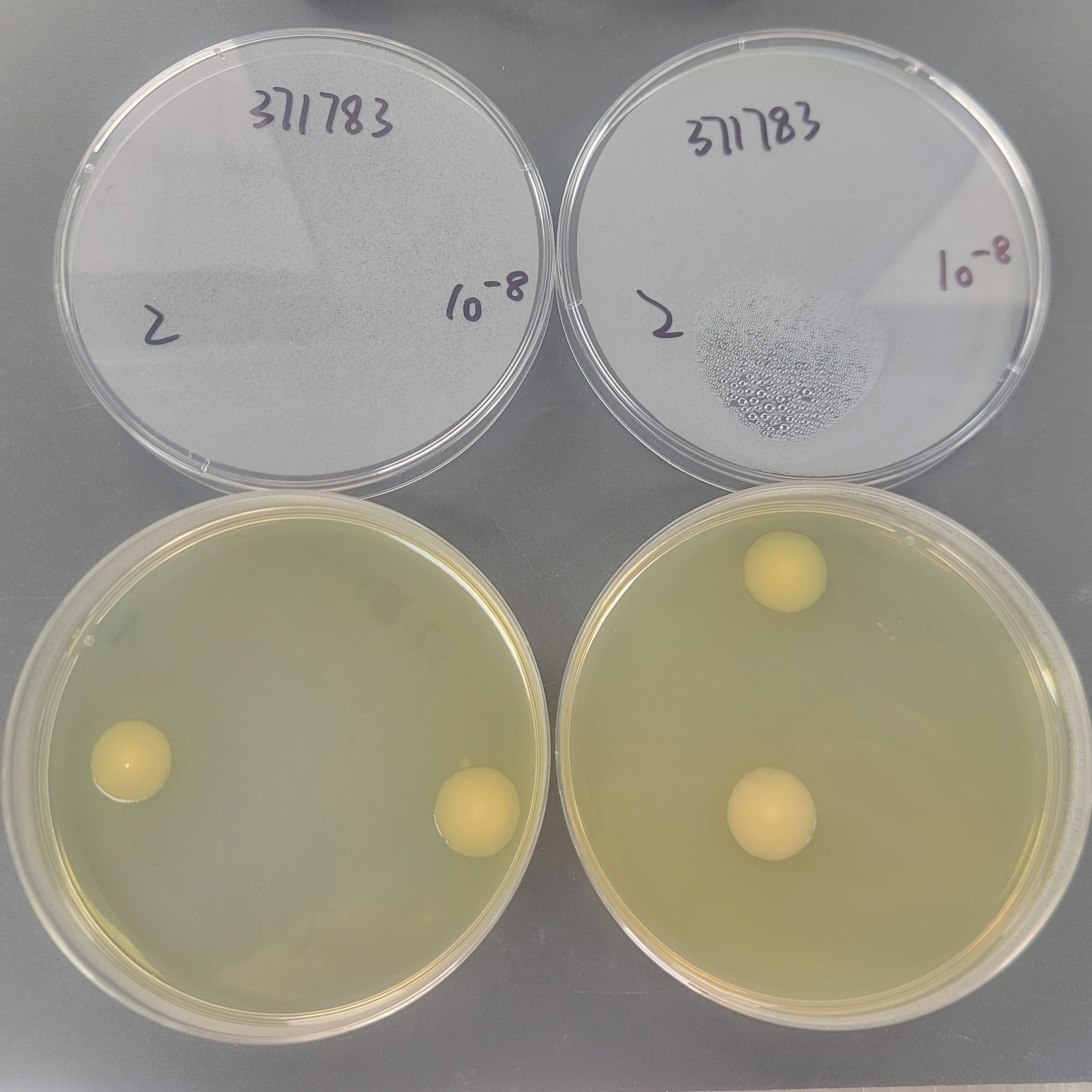 Escherichia coli-BNCC