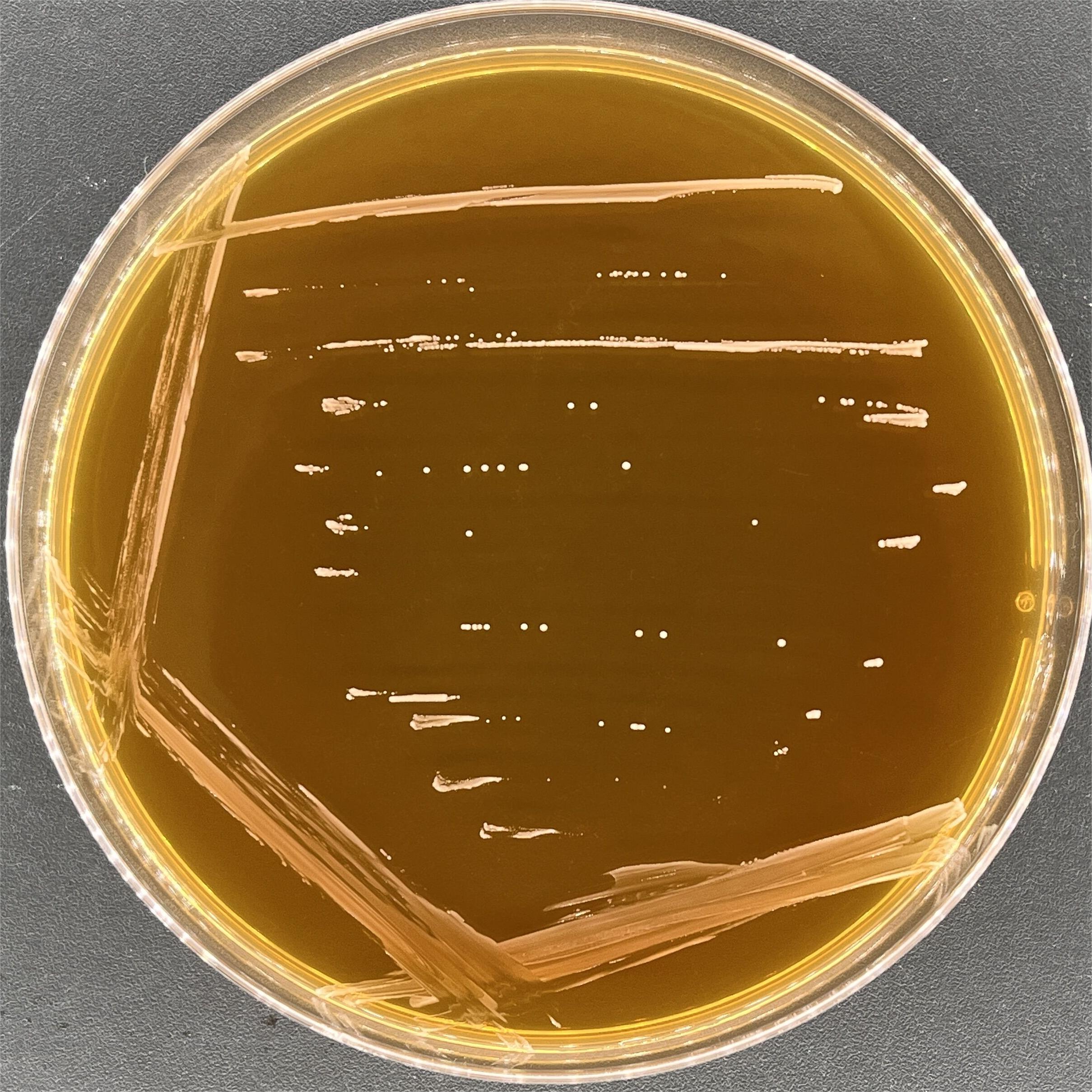 Protease degrading Lactobacillus-BNCC