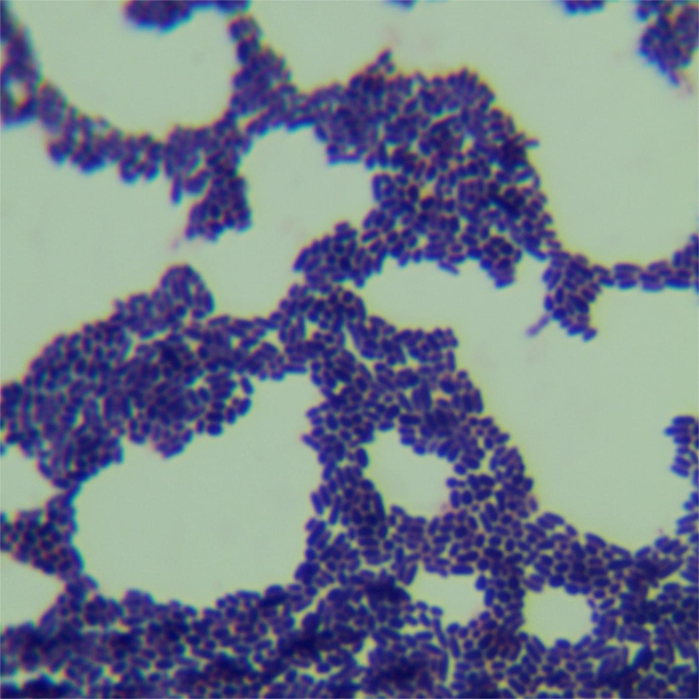 Protease degrading Lactobacillus-BNCC