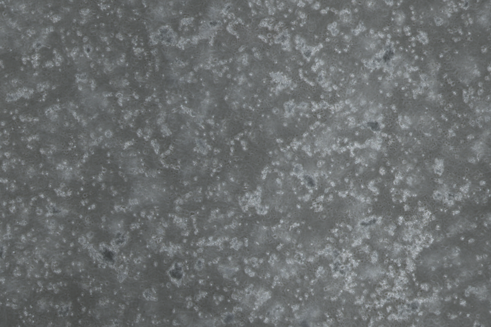 Ross River virus-BNCC