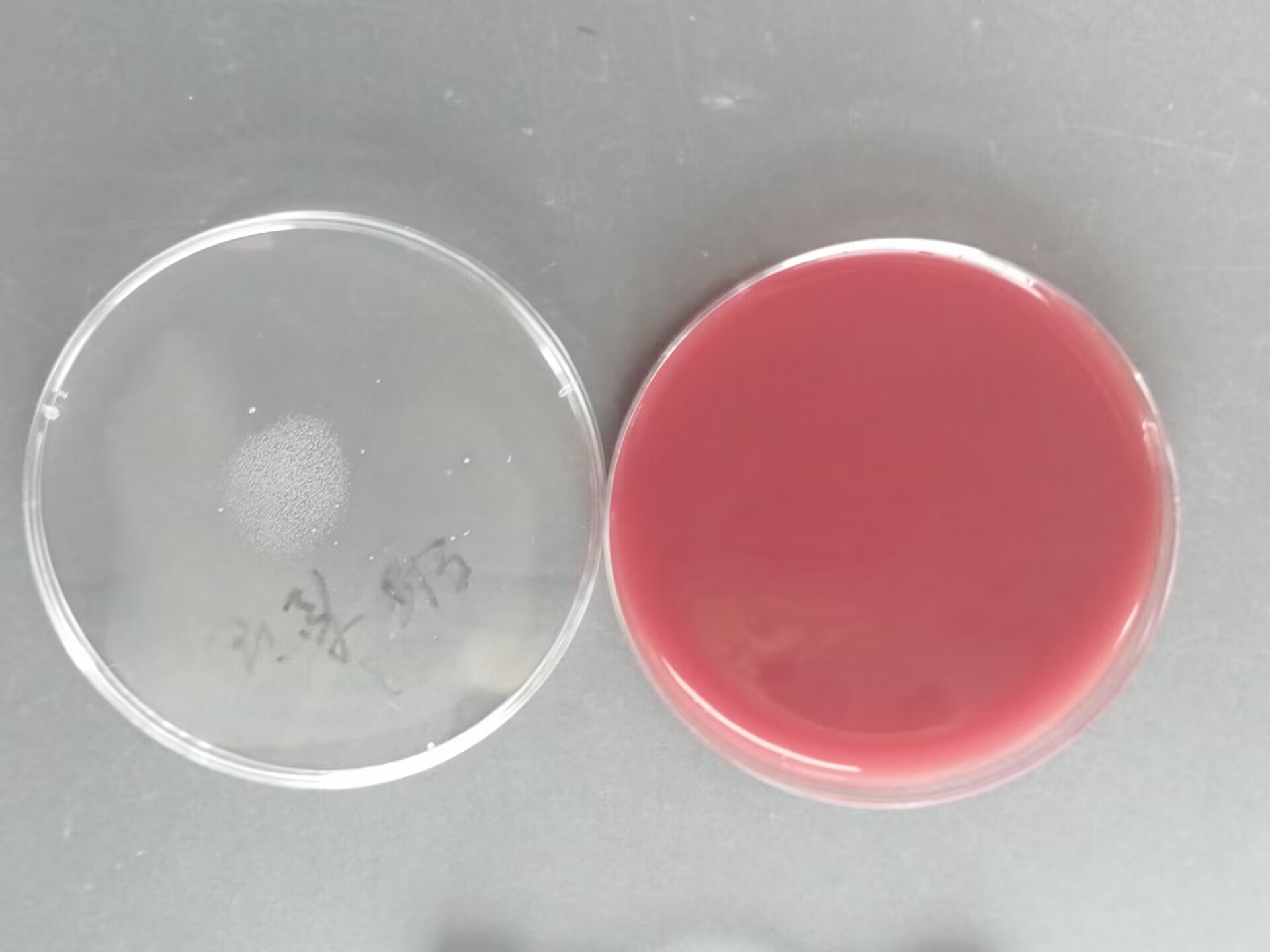 Intermediate Prevotella nucleic acid reference sample (Heat-inactivated) (strongly positive)-BNCC