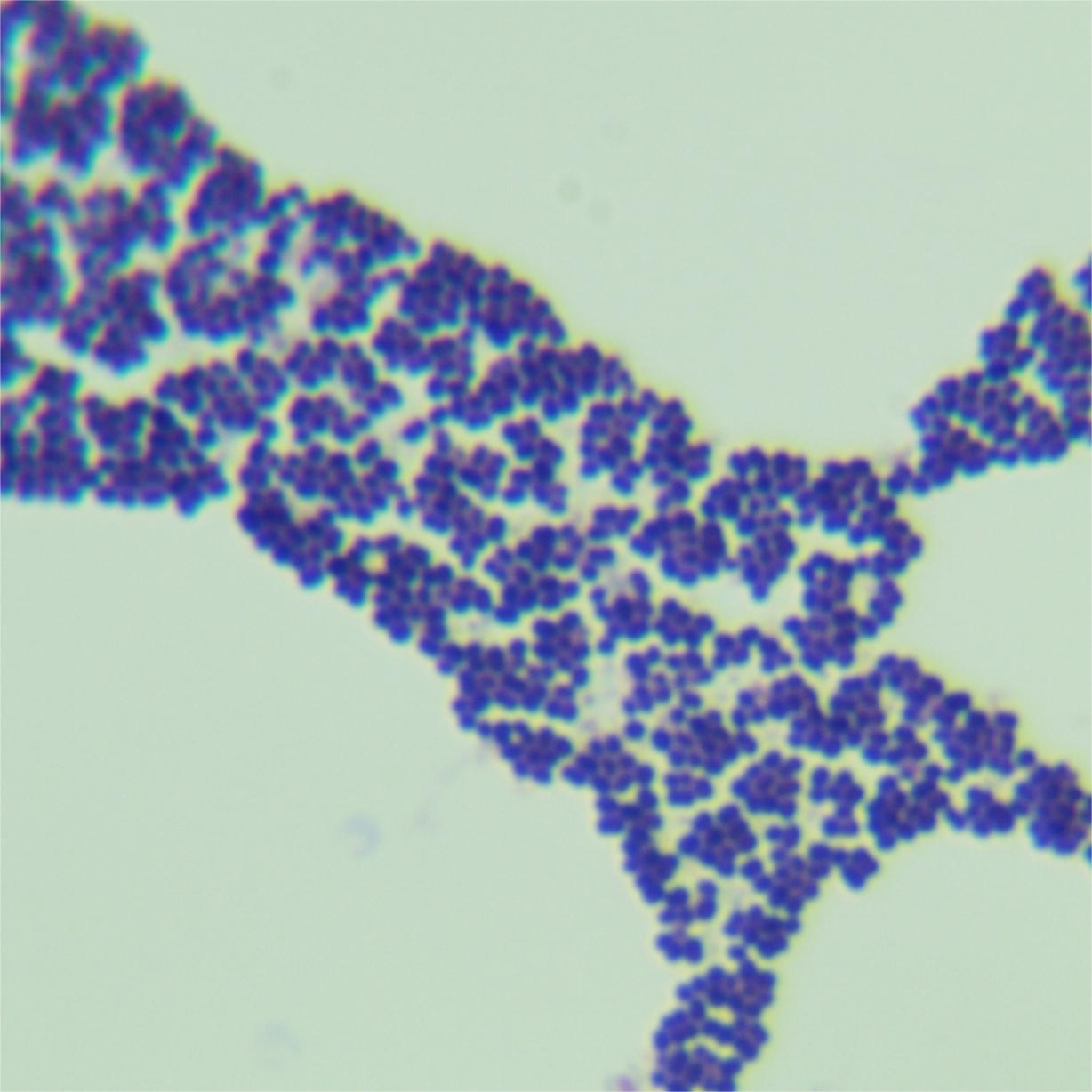 Lactococcus lactis-BNCC