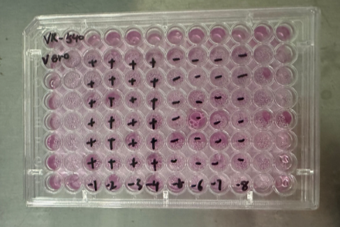 Human Herpesvirus 2-BNCC