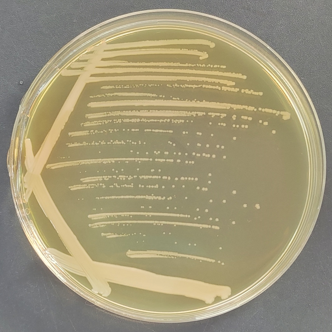 Mysterious Burkholderia-BNCC