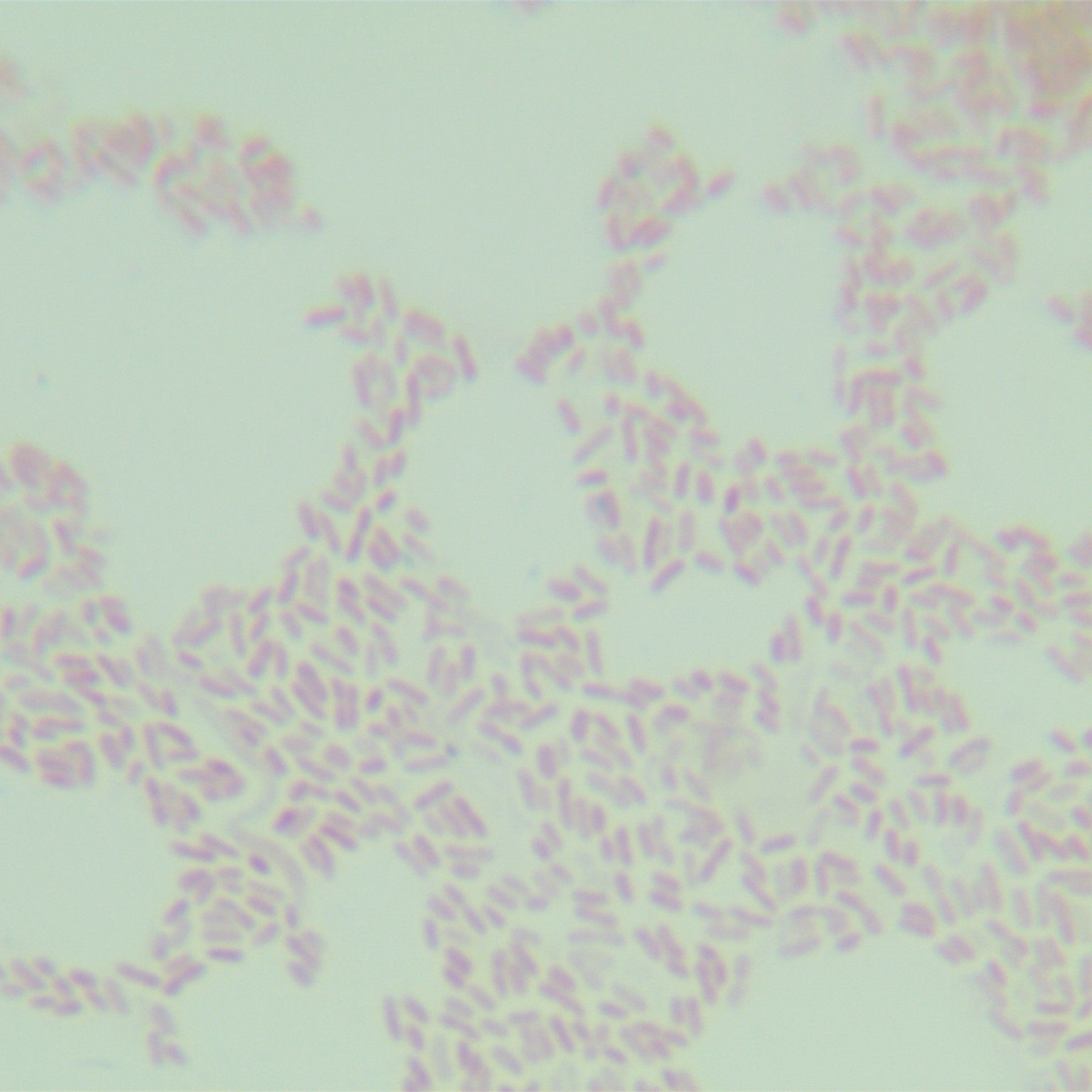 Mysterious Burkholderia-BNCC