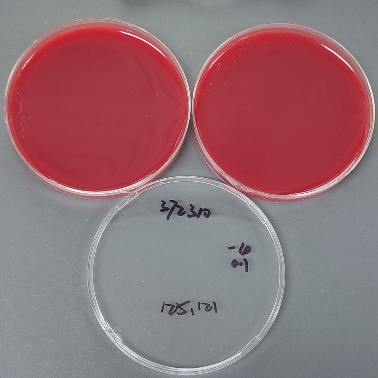Helicobacter pylori-BNCC