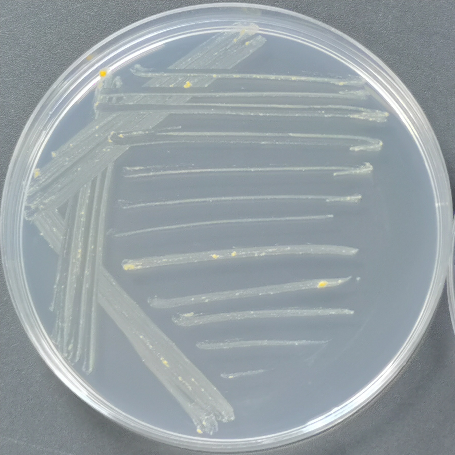 Slow growing yellow mycobacteria-BNCC
