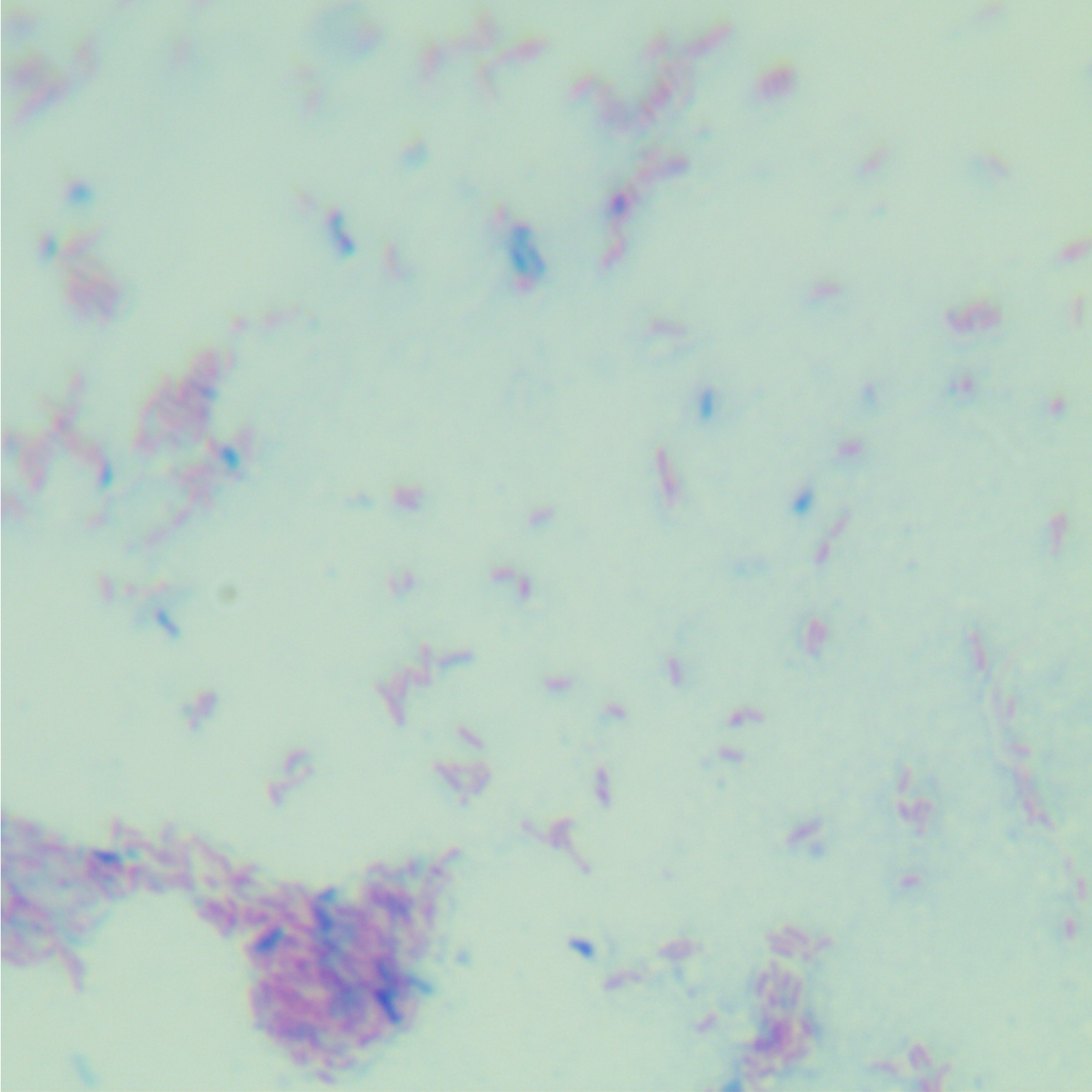 Slow growing yellow mycobacteria-BNCC