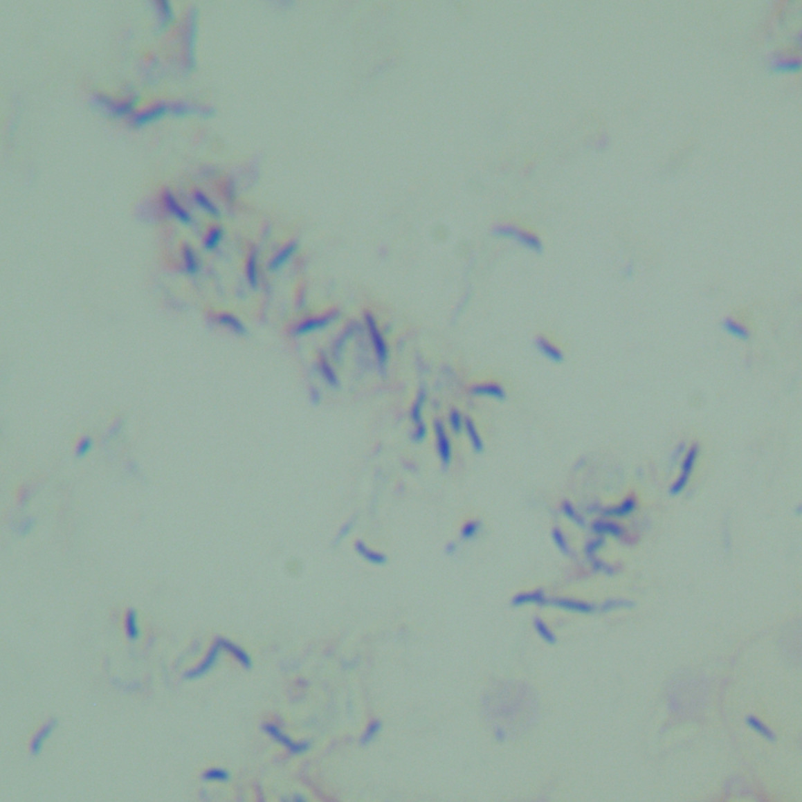 Hemophilic Mycobacterium-BNCC