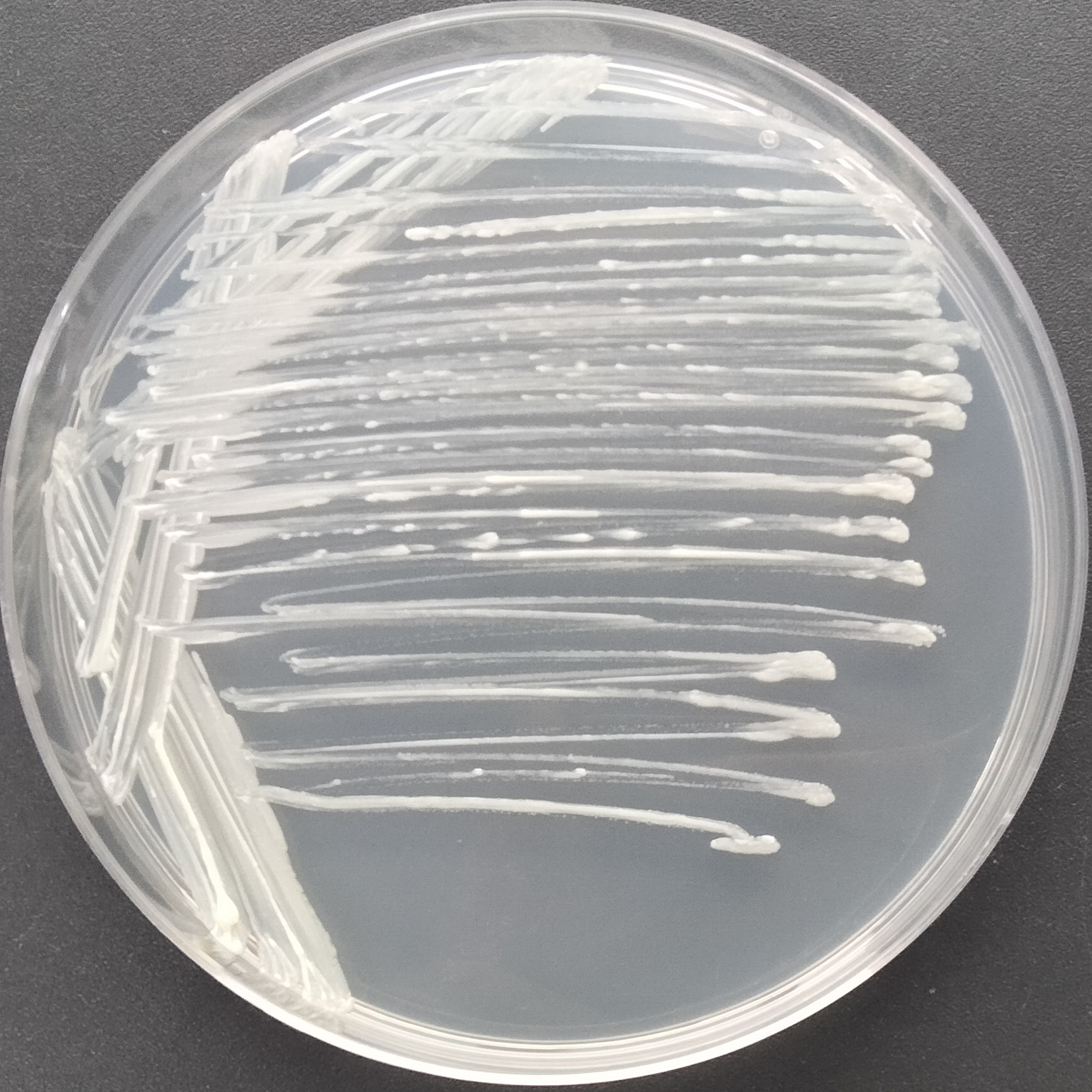 Mycobacterium abscesses-BNCC
