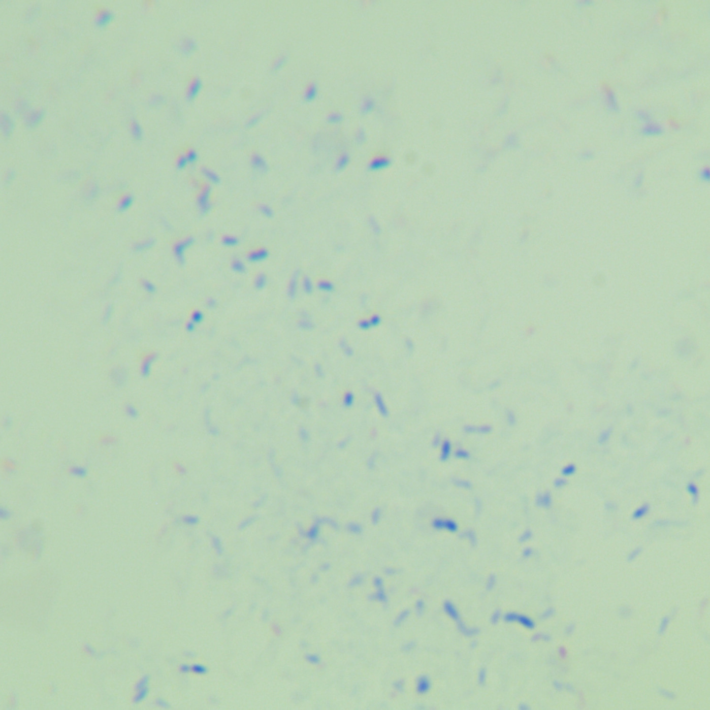 Mycobacterium abscesses-BNCC