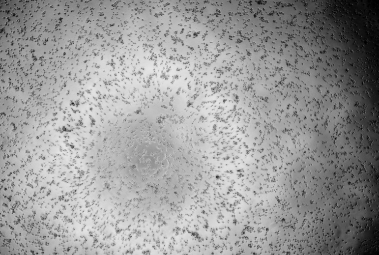 Human rhinovirus 27-BNCC