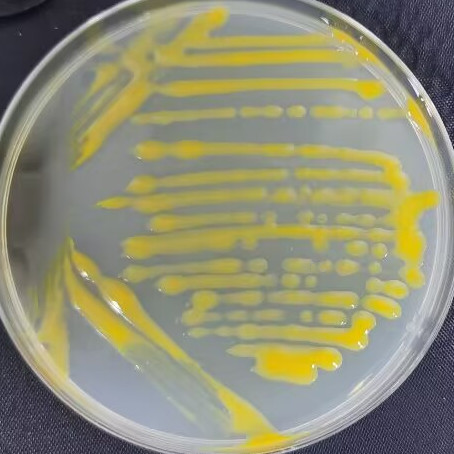 Chitobacteria-BNCC