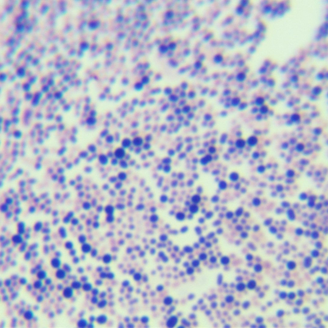 Acinetobacter genus-BNCC