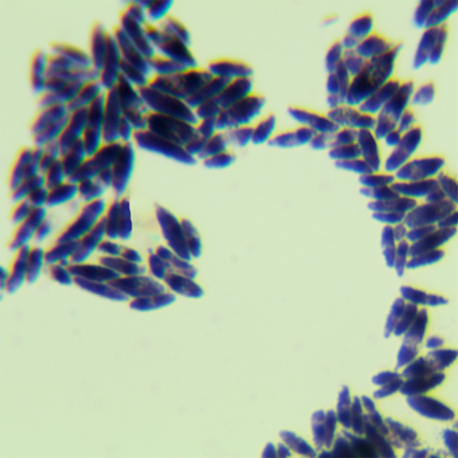 Taphrina vesterghenii-BNCC