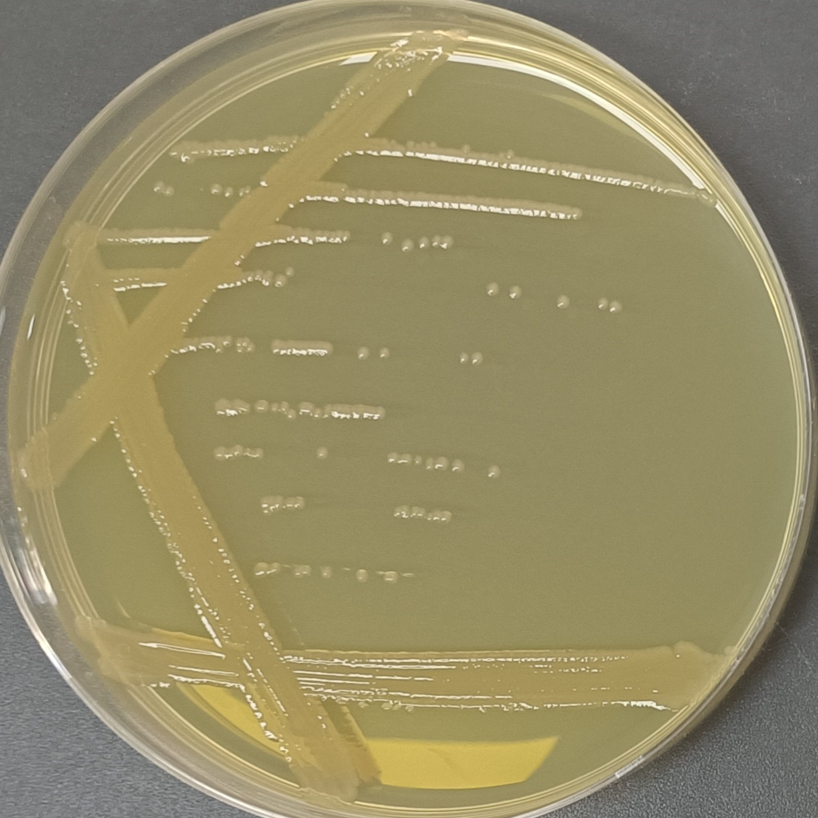 Pseudomonas aeruginosa-BNCC
