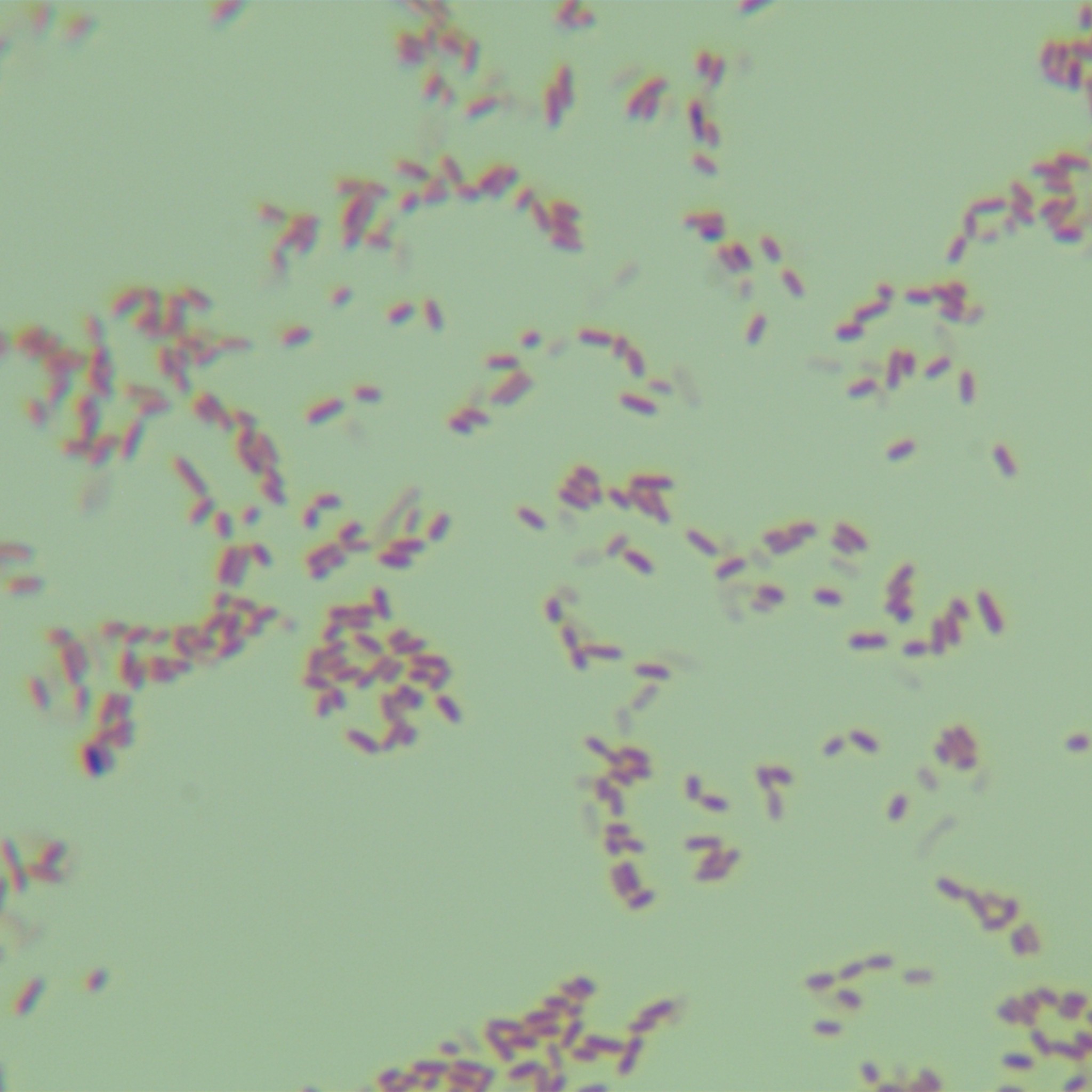 Pseudomonas aeruginosa-BNCC