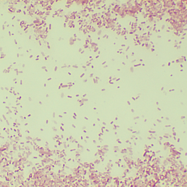 Pseudomonas aeruginosa-BNCC
