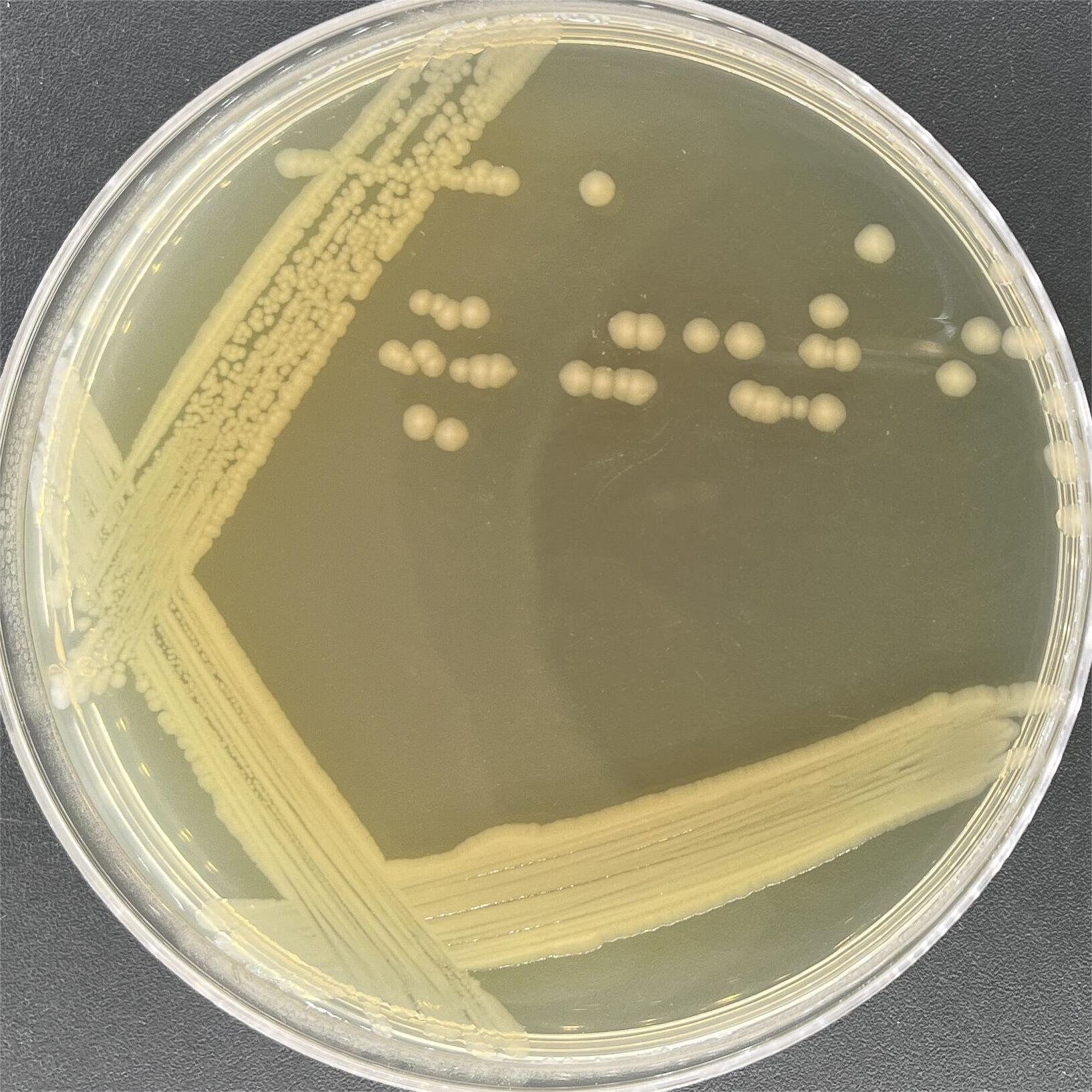 Escherichia coli-BNCC