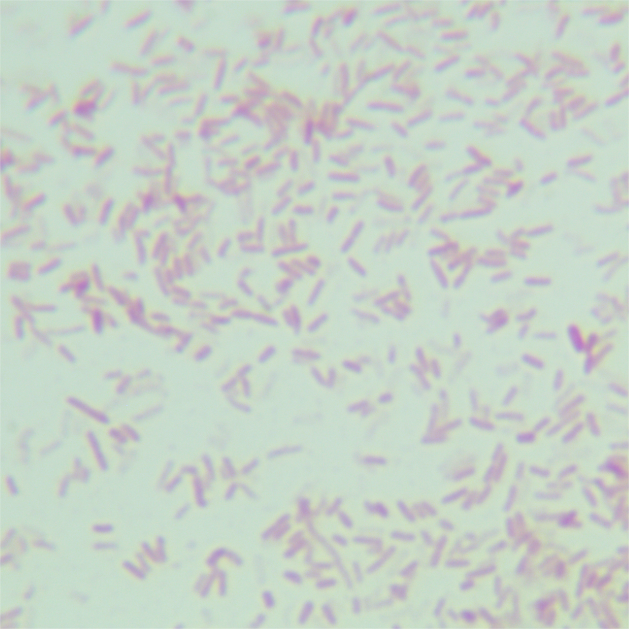 Escherichia coli-BNCC