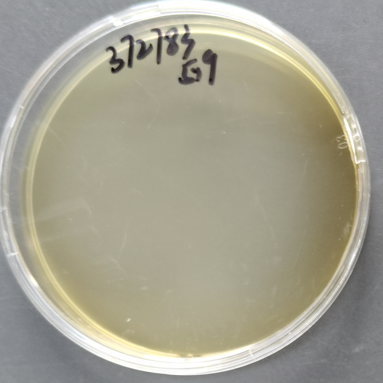 Escherichia coli-BNCC