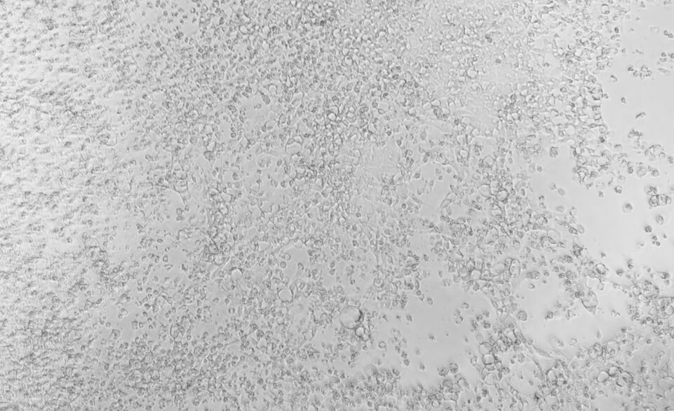 Betacoronavirus 1 OC43-BNCC