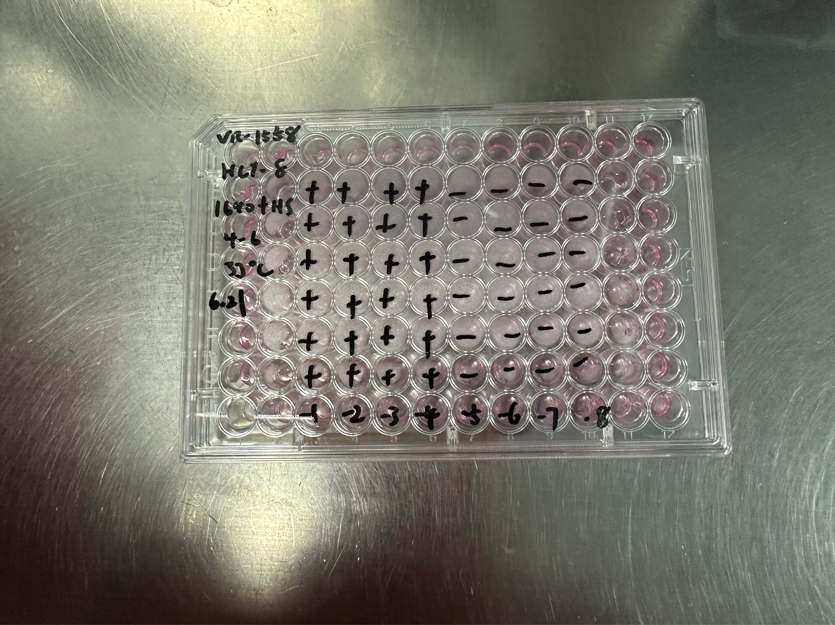 Betacoronavirus 1 OC43-BNCC