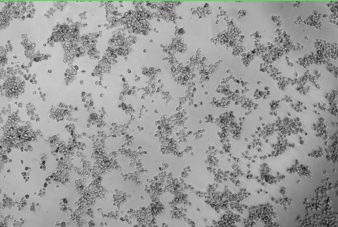 Human rhinovirus 34-BNCC