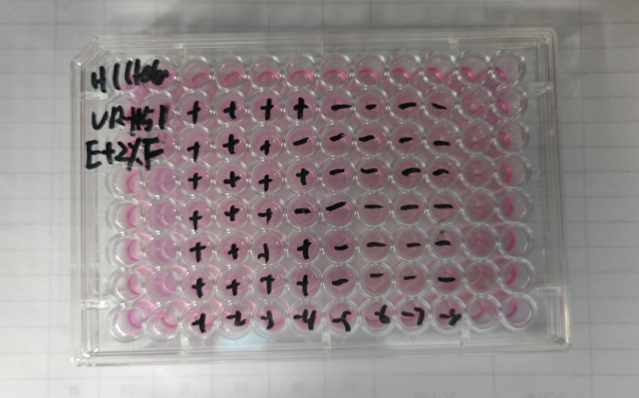 Human rhinovirus 41-BNCC